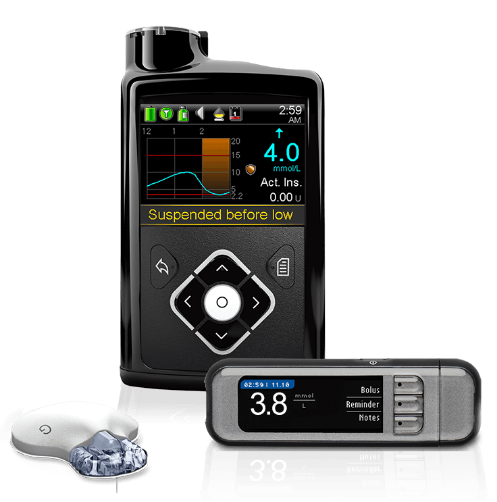 An image of an insulin pump